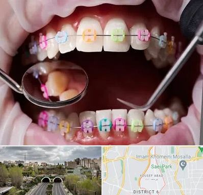 متخصص ارتودنسی در یوسف آباد 