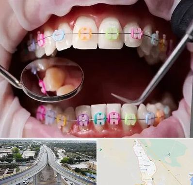 متخصص ارتودنسی در اندیمشک