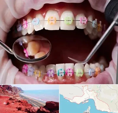 متخصص ارتودنسی در هرمزگان