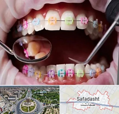 متخصص ارتودنسی در صفادشت