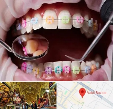 متخصص ارتودنسی در بازار وکیل شیراز