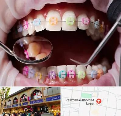 متخصص ارتودنسی در 15 خرداد