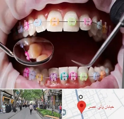 متخصص ارتودنسی در ولیعصر شهریار