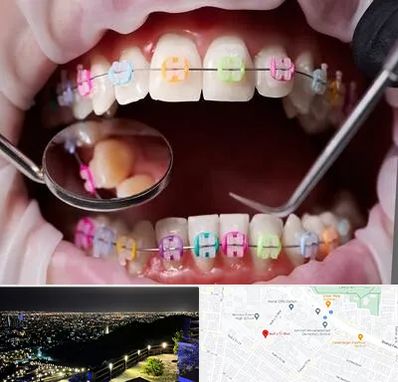 متخصص ارتودنسی در هفت تیر مشهد