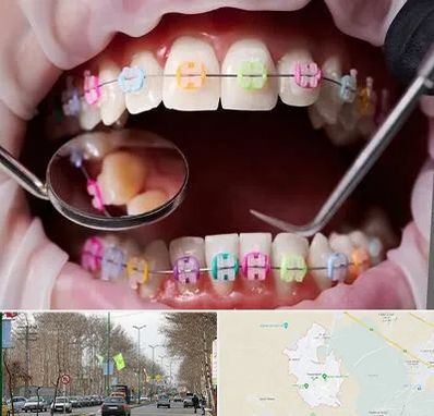 متخصص ارتودنسی در نظرآباد کرج