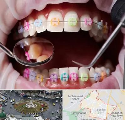 متخصص ارتودنسی در فردیس کرج 