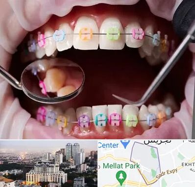 متخصص ارتودنسی در الهیه 