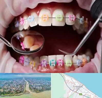 متخصص ارتودنسی در تنکابن