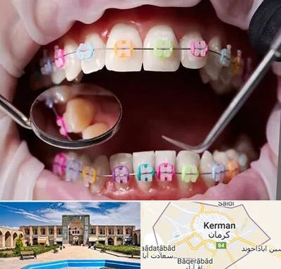 متخصص ارتودنسی در کرمان