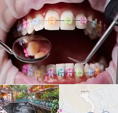 متخصص ارتودنسی در درکه