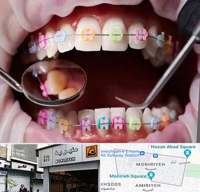 متخصص ارتودنسی در منیریه 
