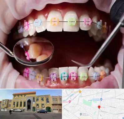 متخصص ارتودنسی در زنبیل آباد قم