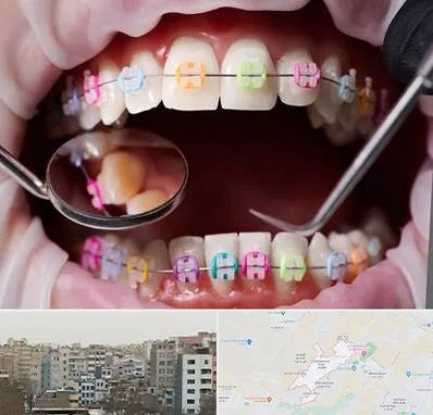 متخصص ارتودنسی در محمد شهر کرج