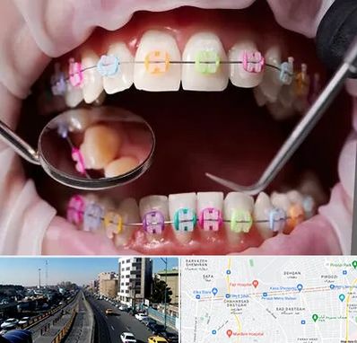 متخصص ارتودنسی در پیروزی 