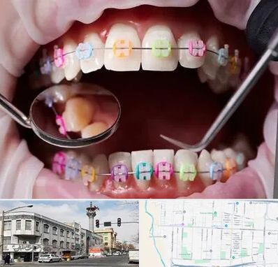 متخصص ارتودنسی در 17شهریور