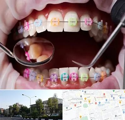 متخصص ارتودنسی در میدان کاج