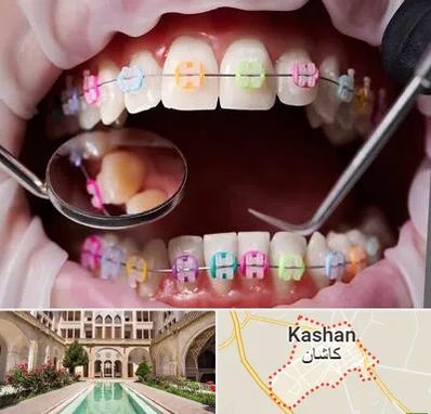 متخصص ارتودنسی در کاشان