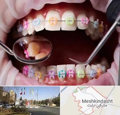 متخصص ارتودنسی در مشکین دشت