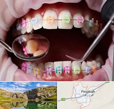 متخصص ارتودنسی در فیروزکوه