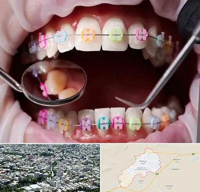 متخصص ارتودنسی در شاهرود