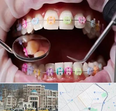 متخصص ارتودنسی در طلاب مشهد