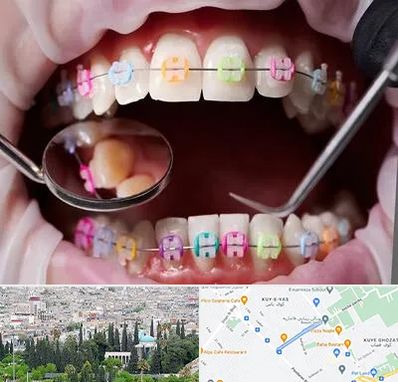 متخصص ارتودنسی در محلاتی شیراز