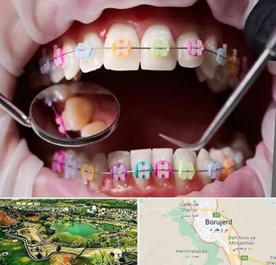 متخصص ارتودنسی در بروجرد