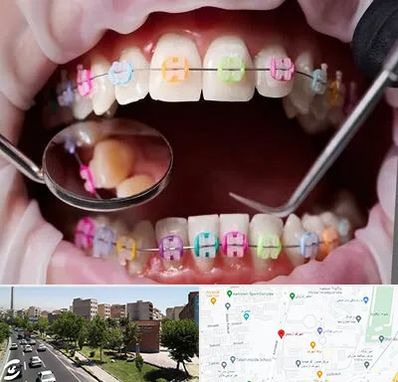 متخصص ارتودنسی در شهرک آزمایش