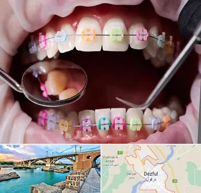 متخصص ارتودنسی در دزفول