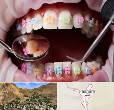 متخصص ارتودنسی در فشم