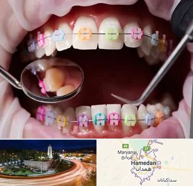 متخصص ارتودنسی در همدان