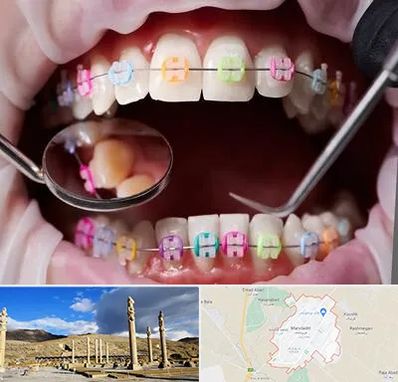 متخصص ارتودنسی در مرودشت