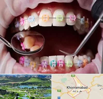 متخصص ارتودنسی در خرم آباد