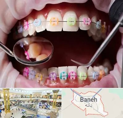 متخصص ارتودنسی در بانه