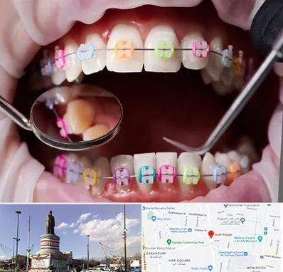 متخصص ارتودنسی در کارگر جنوبی