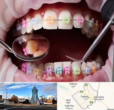 متخصص ارتودنسی در تایباد