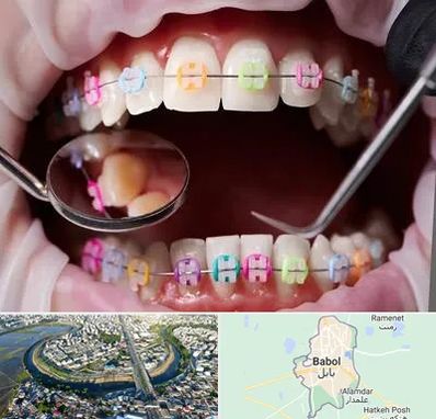متخصص ارتودنسی در بابل
