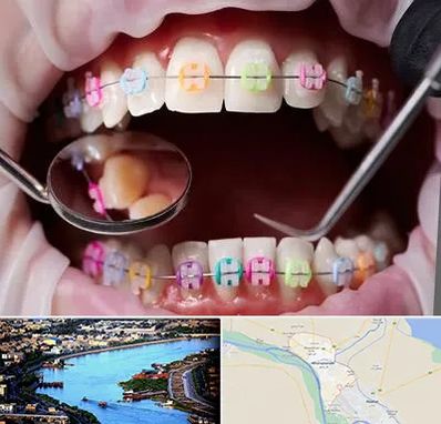 متخصص ارتودنسی در خرمشهر