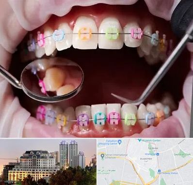 متخصص ارتودنسی در فرشته 