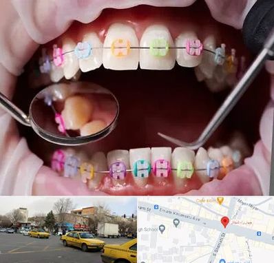 متخصص ارتودنسی در شهناز تبریز