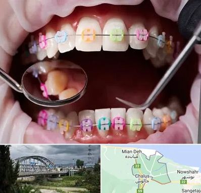 متخصص ارتودنسی در چالوس
