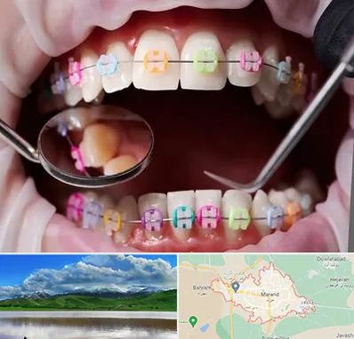 متخصص ارتودنسی در مرند