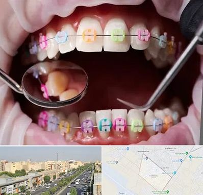 متخصص ارتودنسی در کیانمهر کرج