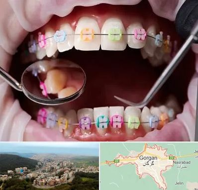 متخصص ارتودنسی در گرگان