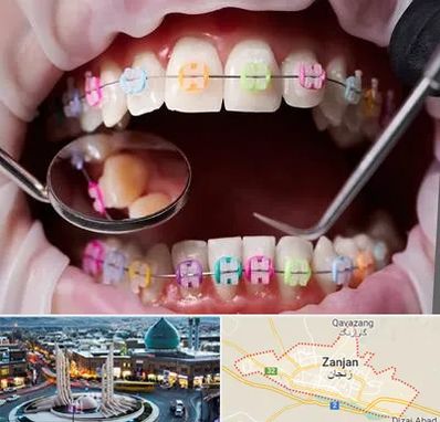 متخصص ارتودنسی در زنجان