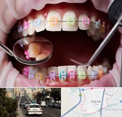 متخصص ارتودنسی در خطیب تبریز