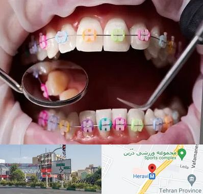 متخصص ارتودنسی در هروی 