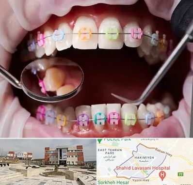 متخصص ارتودنسی در حکیمیه 