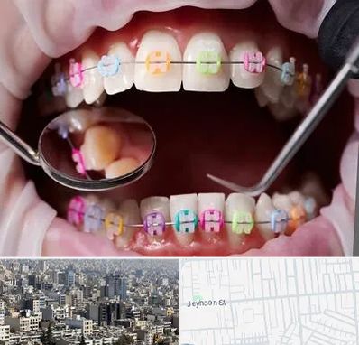 متخصص ارتودنسی در جیحون