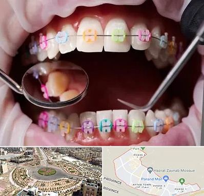 متخصص ارتودنسی در پرند